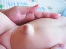 navelbreuk bij baby