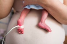 Gevolgen prematuur geboren baby